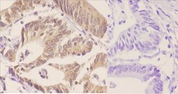Phospho-p70 S6 Kinase (Thr421) Polyclonal Antibody:Antibodies, Polyclonal
