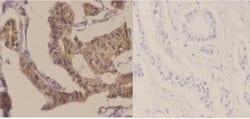 Phospho-p70 S6 Kinase (Thr421) Polyclonal Antibody:Antibodies, Polyclonal