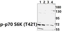 Phospho-p70 S6 Kinase (Thr421) Polyclonal Antibody:Antibodies, Polyclonal