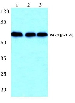 Invitrogen Phospho-PAK3 (Ser154) Polyclonal Antibody 100 &mu;L | Buy Online | Invitrogen&trade; | Fisher Scientific