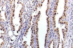 Invitrogen Phospho-STAT5 alpha (Ser780) Polyclonal Antibody 100 &mu;L;