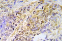 Invitrogen Phospho-CHK2 (Thr387) Polyclonal Antibody 100 &mu;L; Unconjugated:Antibodies,
