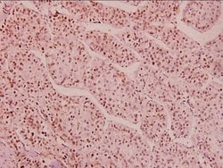 Invitrogen Phospho-HDAC1 (Ser421, Ser423) Polyclonal Antibody 100 &mu;L | Buy Online | Invitrogen&trade; | Fisher Scientific