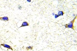 Invitrogen LIMK1/LIMK2 Polyclonal Antibody 100 μL; Unconjugated:Antibodies,