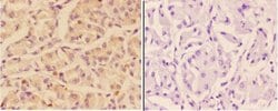 Invitrogen Adenylate Cyclase 9 Polyclonal Antibody 100 &mu;L; Unconjugated:Antibodies,