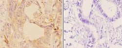 Invitrogen Adenylate Cyclase 9 Polyclonal Antibody 100 &mu;L; Unconjugated:Antibodies,