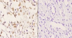 Invitrogen AKAP8 Polyclonal Antibody 100 μL; Unconjugated:Antibodies,