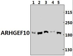 Invitrogen ARHGEF10 Polyclonal Antibody 100 &mu;L; Unconjugated:Antibodies,