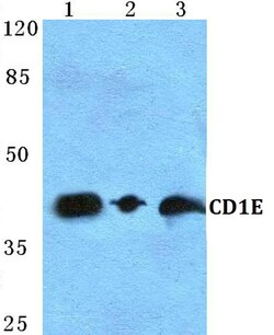 Invitrogen CD1e Polyclonal Antibody 100 &mu;L | Buy Online | Invitrogen&trade; | Fisher Scientific