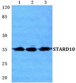 Invitrogen STARD10 Polyclonal Antibody 100 &mu;L; Unconjugated:Antibodies,