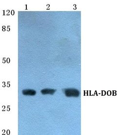 Invitrogen HLA-DOB Polyclonal Antibody 100 &mu;L | Buy Online | Invitrogen&trade; | Fisher Scientific