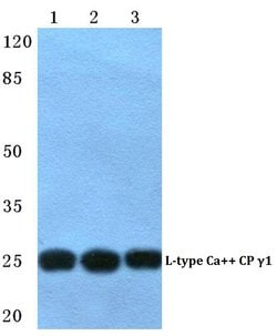 Invitrogen CACNG1 Polyclonal Antibody 100 &mu;L; Unconjugated:Antibodies,