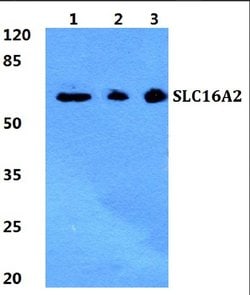 Invitrogen SLC16A2 Polyclonal Antibody 100 &mu;L; Unconjugated:Antibodies,