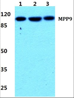 Invitrogen MPP9 Polyclonal Antibody 100 &mu;L | Buy Online | Invitrogen&trade; | Fisher Scientific