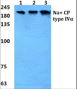 Invitrogen SCN4A Polyclonal Antibody 100 &mu;L; Unconjugated:Antibodies,