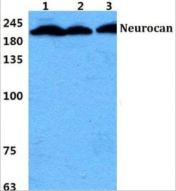 Invitrogen Neurocan Polyclonal Antibody 100 &mu;L | Buy Online | Invitrogen&trade; | Fisher Scientific