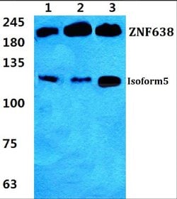 Invitrogen ZNF638 Polyclonal Antibody 100 &mu;L; Unconjugated:Antibodies,