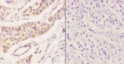 Invitrogen PEX11B Polyclonal Antibody 100 &mu;L; Unconjugated:Antibodies,