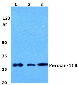 Invitrogen PEX11B Polyclonal Antibody 100 &mu;L; Unconjugated:Antibodies,