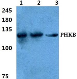 Invitrogen PHKB Polyclonal Antibody 100 &mu;L; Unconjugated:Antibodies,