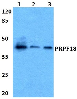 Invitrogen PRPF18 Polyclonal Antibody 100 &mu;L; Unconjugated:Antibodies,