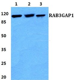 Invitrogen RAB3GAP1 Polyclonal Antibody 100 &mu;L | Buy Online | Invitrogen&trade; | Fisher Scientific