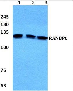 Invitrogen RANBP6 Polyclonal Antibody 100 &mu;L; Unconjugated:Antibodies,