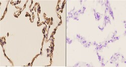 Invitrogen CHML Polyclonal Antibody 100 &mu;L; Unconjugated:Antibodies,