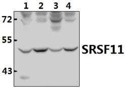 Invitrogen SRSF11 Polyclonal Antibody 100 &mu;L | Buy Online | Invitrogen&trade; | Fisher Scientific