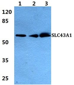 Invitrogen SLC43A1 Polyclonal Antibody 100 &mu;L | Buy Online | Invitrogen&trade; | Fisher Scientific