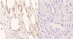 Invitrogen SSBP2 Polyclonal Antibody 100 &mu;L; Unconjugated:Antibodies,