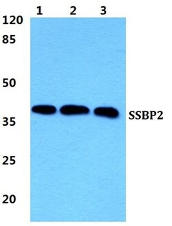 Invitrogen SSBP2 Polyclonal Antibody 100 &mu;L; Unconjugated:Antibodies,