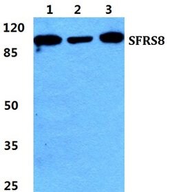 Invitrogen SFRS8 Polyclonal Antibody 100 &mu;L; Unconjugated:Antibodies,