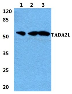 Invitrogen TADA2L Polyclonal Antibody 100 &mu;L; Unconjugated:Antibodies,