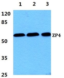 Invitrogen ZP4 Polyclonal Antibody 100 &mu;L; Unconjugated:Antibodies,