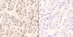 ZNF50 Polyclonal Antibody:Antibodies, Polyclonal