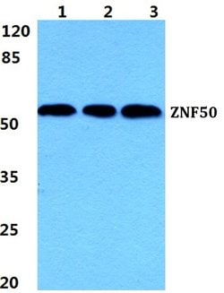 ZNF50 Polyclonal Antibody:Antibodies, Polyclonal