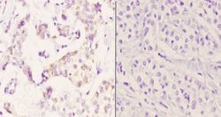 Invitrogen PTGR2 Polyclonal Antibody 100 &mu;L; Unconjugated:Antibodies,