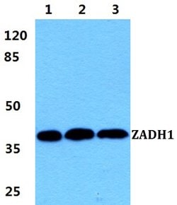 Invitrogen PTGR2 Polyclonal Antibody 100 &mu;L; Unconjugated:Antibodies,