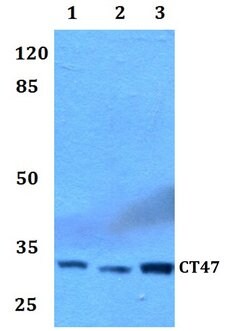 Invitrogen CT47 Polyclonal Antibody 100 &mu;L; Unconjugated:Antibodies,