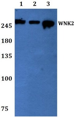 Invitrogen WNK2 Polyclonal Antibody 100 &mu;L; Unconjugated:Antibodies,