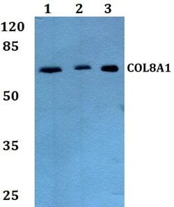 Invitrogen COL8A1 Polyclonal Antibody 100 &mu;L; Unconjugated:Antikroppar