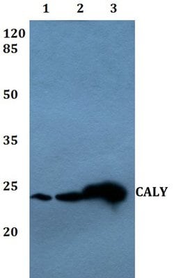 Invitrogen CALY Polyclonal Antibody 100 &mu;L; Unconjugated:Antibodies,