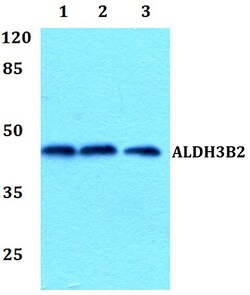 Invitrogen ALDH3B2 Polyclonal Antibody 100 &mu;L; Unconjugated:Antibodies,
