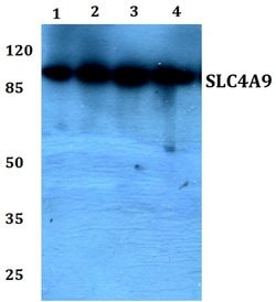 Invitrogen SLC4A9 Polyclonal Antibody 100 &mu;L; Unconjugated:Antibodies,