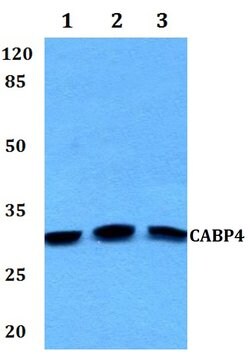 Invitrogen CABP4 Polyclonal Antibody 100 &mu;L; Unconjugated:Antibodies,