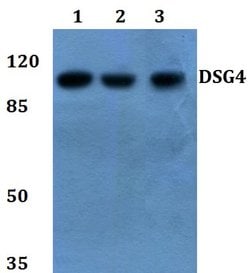 Invitrogen Desmoglein 4 Polyclonal Antibody 100 &mu;L; Unconjugated:Antibodies,
