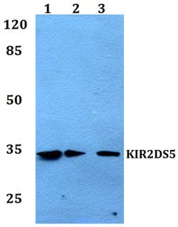 Invitrogen KIR2DS5 Polyclonal Antibody 100 &mu;L; Unconjugated:Antibodies,