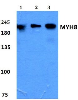 Invitrogen MYH8 Polyclonal Antibody 100 &mu;L; Unconjugated:Antibodies,