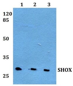 Invitrogen SHOX Polyclonal Antibody 100 &mu;L; Unconjugated:Antibodies,